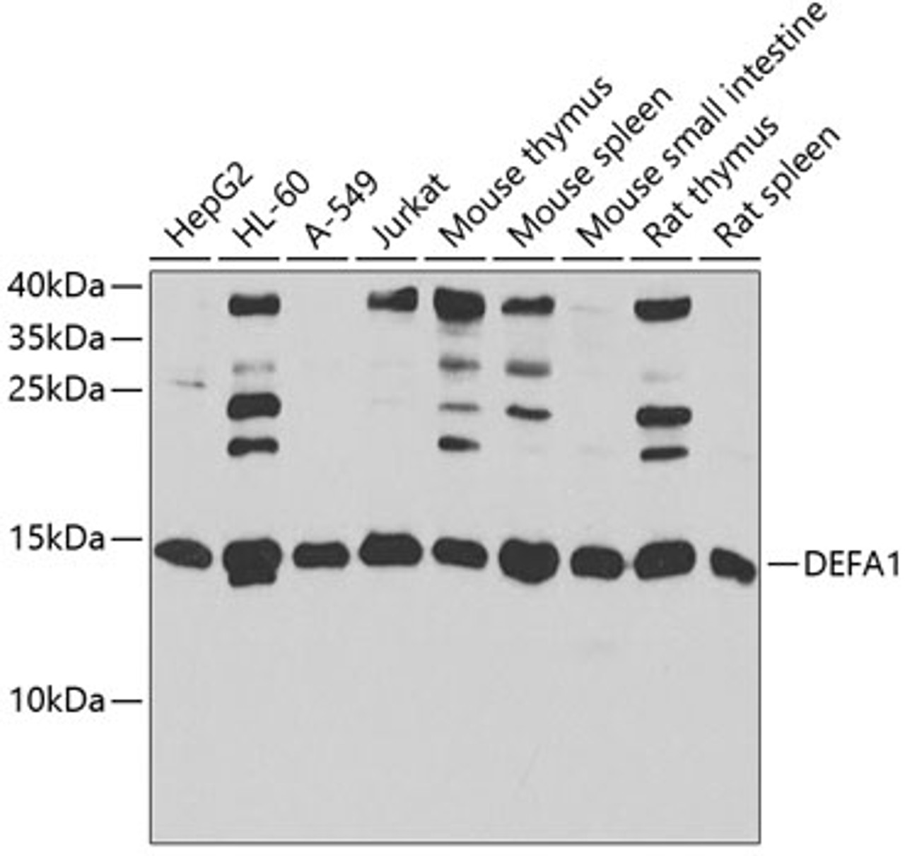 Western blot analysis of extracts of various cell lines, using DEFA1 antibody (22-537) at 1:1000 dilution.<br/>Secondary antibody: HRP Goat Anti-Rabbit IgG (H+L) at 1:10000 dilution.<br/>Lysates/proteins: 25ug per lane.<br/>Blocking buffer: 3% nonfat dry milk in TBST.<br/>Detection: ECL Basic Kit.<br/>Exposure time: 60s.