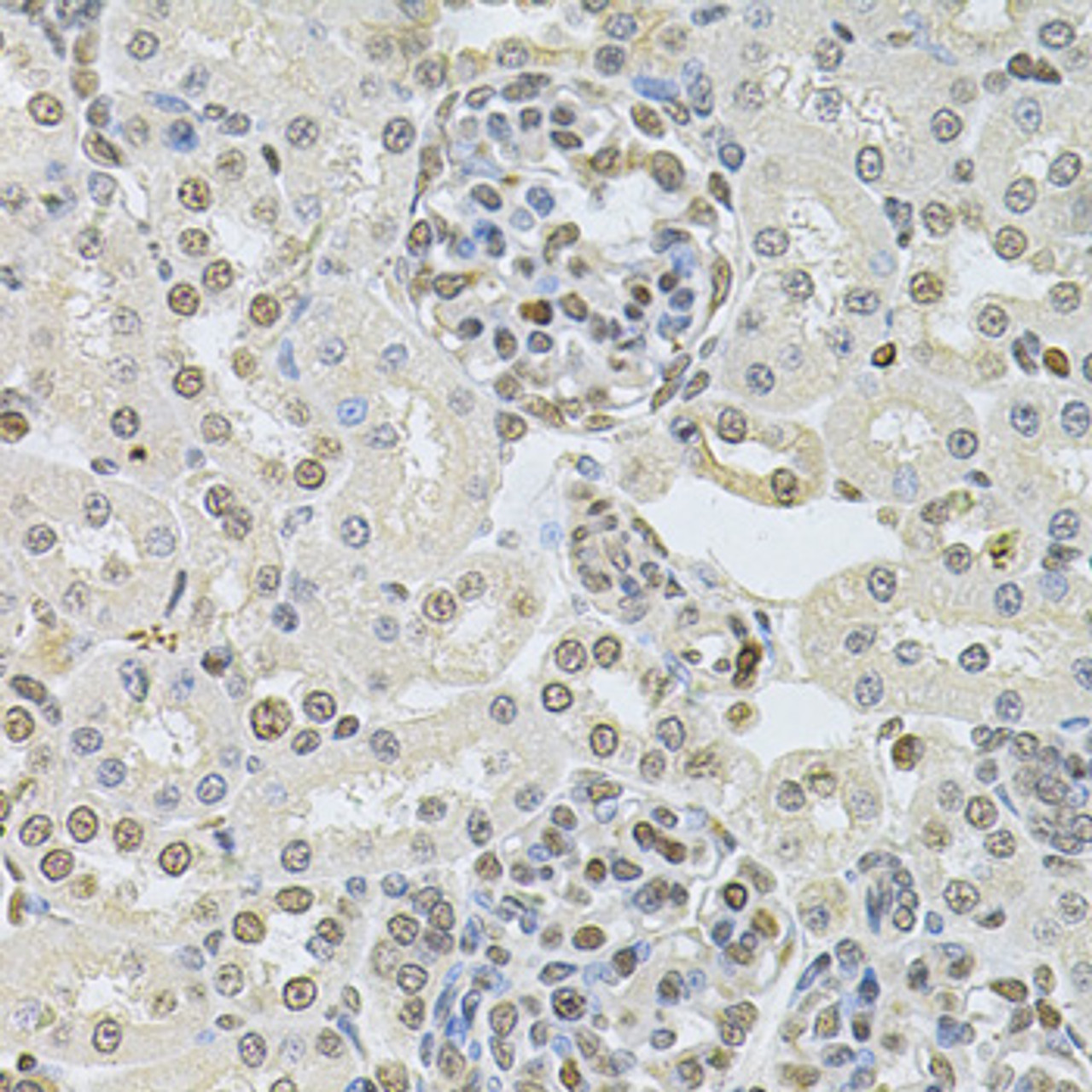Immunohistochemistry of paraffin-embedded rat kidney using DR1 Antibody (22-542) at dilution of 1:100 (40x lens) .