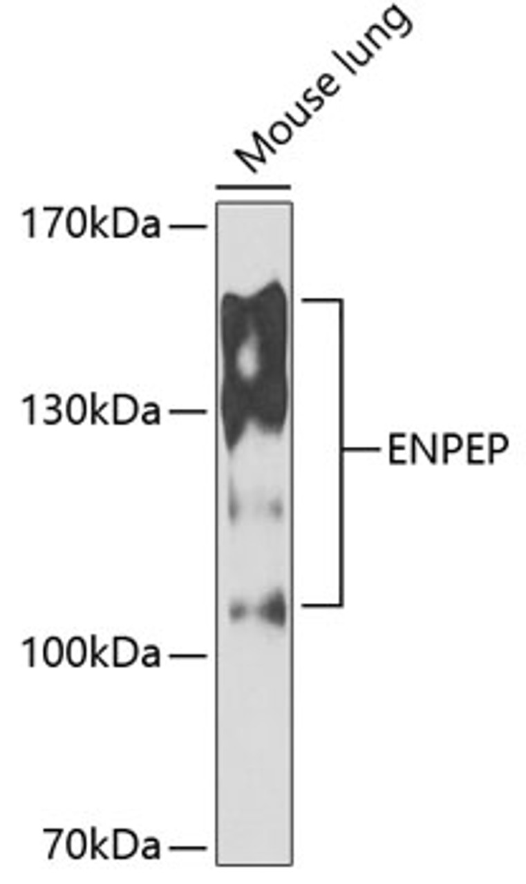 Western blot analysis of extracts of mouse lung, using ENPEP antibody (22-543) at 1:1000 dilution.<br/>Secondary antibody: HRP Goat Anti-Rabbit IgG (H+L) at 1:10000 dilution.<br/>Lysates/proteins: 25ug per lane.<br/>Blocking buffer: 3% nonfat dry milk in TBST.<br/>Detection: ECL Enhanced Kit.<br/>Exposure time: 90s.
