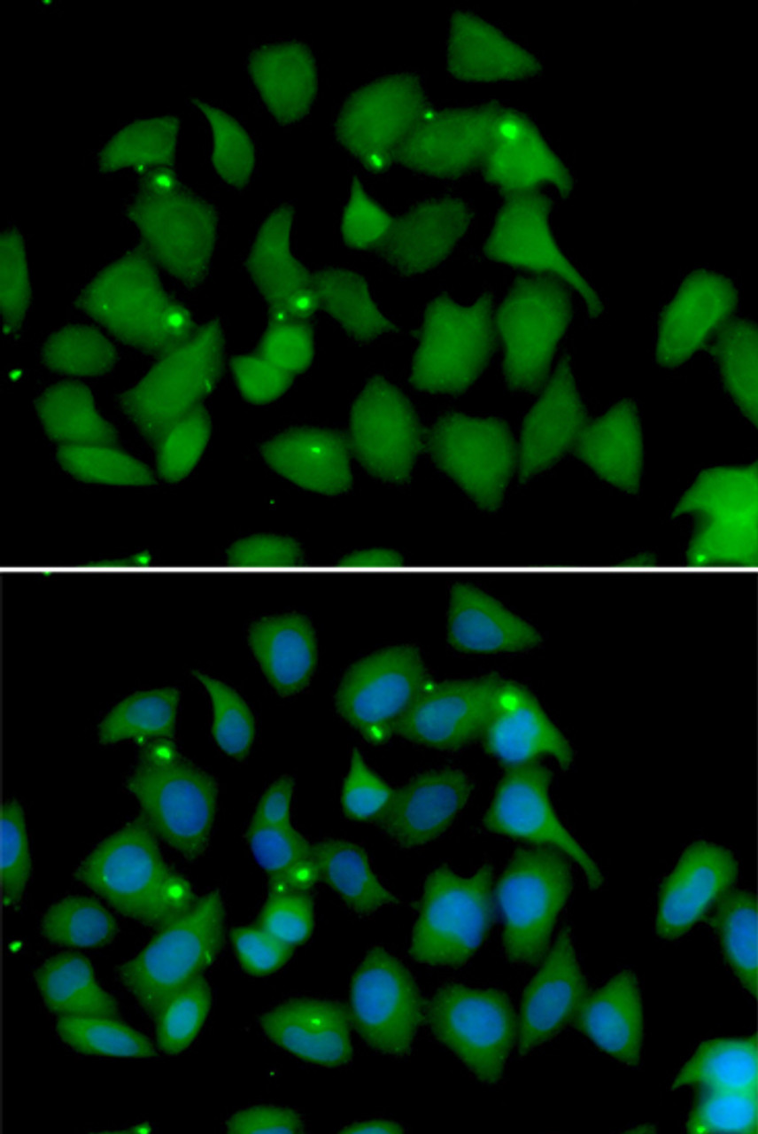 Immunofluorescence analysis of HeLa cells using FMO1 antibody (22-546) . Blue: DAPI for nuclear staining.