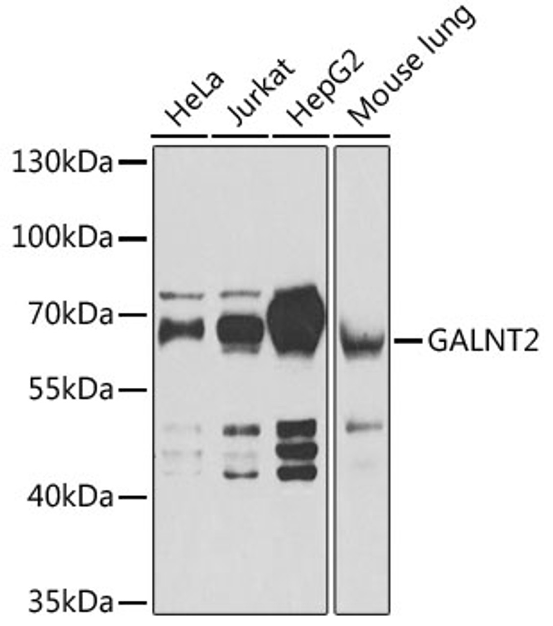 Western blot analysis of extracts of various cell lines, using GALNT2 antibody (22-548) at 1:1000 dilution.<br/>Secondary antibody: HRP Goat Anti-Rabbit IgG (H+L) at 1:10000 dilution.<br/>Lysates/proteins: 25ug per lane.<br/>Blocking buffer: 3% nonfat dry milk in TBST.<br/>Detection: ECL Basic Kit.<br/>Exposure time: 1s.