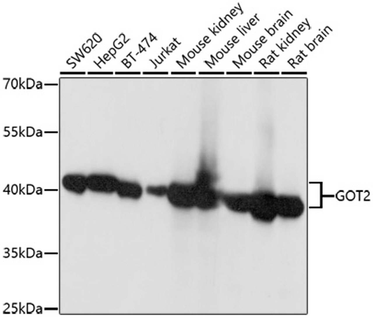 Immunohistochemistry of paraffin-embedded rat kidney using GOT2 antibody (22-551) at dilution of 1:100 (40x lens) .