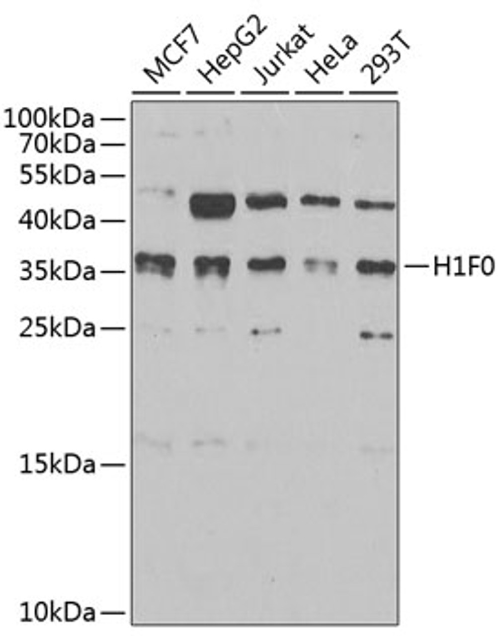 Western blot analysis of extracts of various cell lines, using Histone H1.0 antibody (22-554) at 1:1000 dilution.<br/>Secondary antibody: HRP Goat Anti-Rabbit IgG (H+L) at 1:10000 dilution.<br/>Lysates/proteins: 25ug per lane.<br/>Blocking buffer: 3% nonfat dry milk in TBST.<br/>Detection: ECL Basic Kit.<br/>Exposure time: 90s.