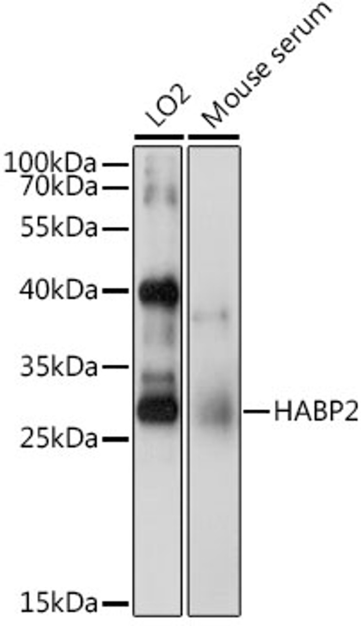 Western blot analysis of extracts of various cell lines, using HABP2 antibody (22-555) at 1:1000 dilution.<br/>Secondary antibody: HRP Goat Anti-Rabbit IgG (H+L) at 1:10000 dilution.<br/>Lysates/proteins: 25ug per lane.<br/>Blocking buffer: 3% nonfat dry milk in TBST.<br/>Detection: ECL Basic Kit.<br/>Exposure time: 15s.