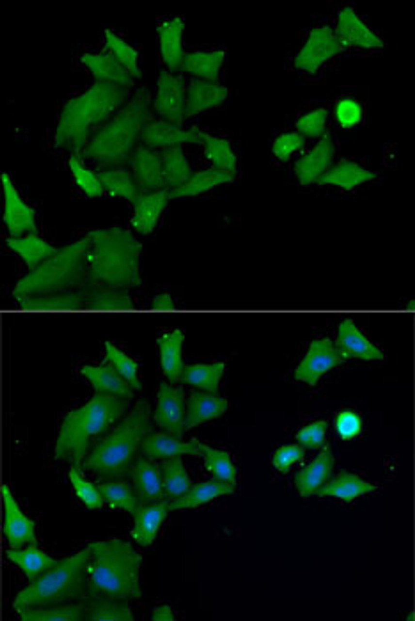 Immunofluorescence analysis of MCF7 cells using HABP2 antibody (22-555) . Blue: DAPI for nuclear staining.