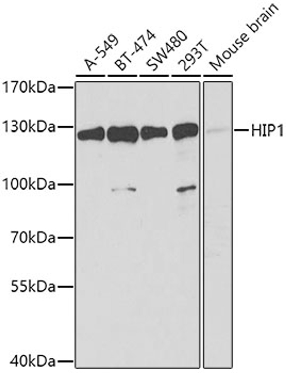 Western blot analysis of extracts of various cell lines, using HIP1 antibody (22-556) at 1:1000 dilution.<br/>Secondary antibody: HRP Goat Anti-Rabbit IgG (H+L) at 1:10000 dilution.<br/>Lysates/proteins: 25ug per lane.<br/>Blocking buffer: 3% nonfat dry milk in TBST.<br/>Detection: ECL Basic Kit.<br/>Exposure time: 90s.