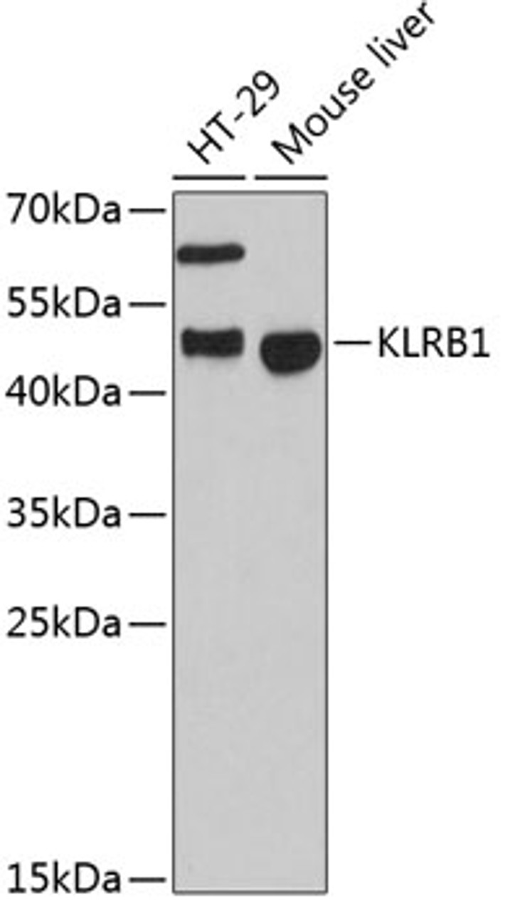 Western blot analysis of extracts of various cell lines, using KLRB1 antibody (22-562) at 1:3000 dilution._Secondary antibody: HRP Goat Anti-Rabbit IgG (H+L) at 1:10000 dilution._Lysates/proteins: 25ug per lane._Blocking buffer: 3% nonfat dry milk in TBST._Detection: ECL Enhanced Kit._Exposure time: 90s.