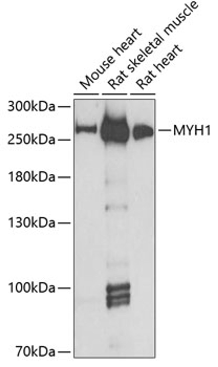 Western blot analysis of extracts of various cell lines, using MYH1 antibody (22-566) at 1:1000 dilution.<br/>Secondary antibody: HRP Goat Anti-Rabbit IgG (H+L) at 1:10000 dilution.<br/>Lysates/proteins: 25ug per lane.<br/>Blocking buffer: 3% nonfat dry milk in TBST.<br/>Detection: ECL Basic Kit.<br/>Exposure time: 60s.