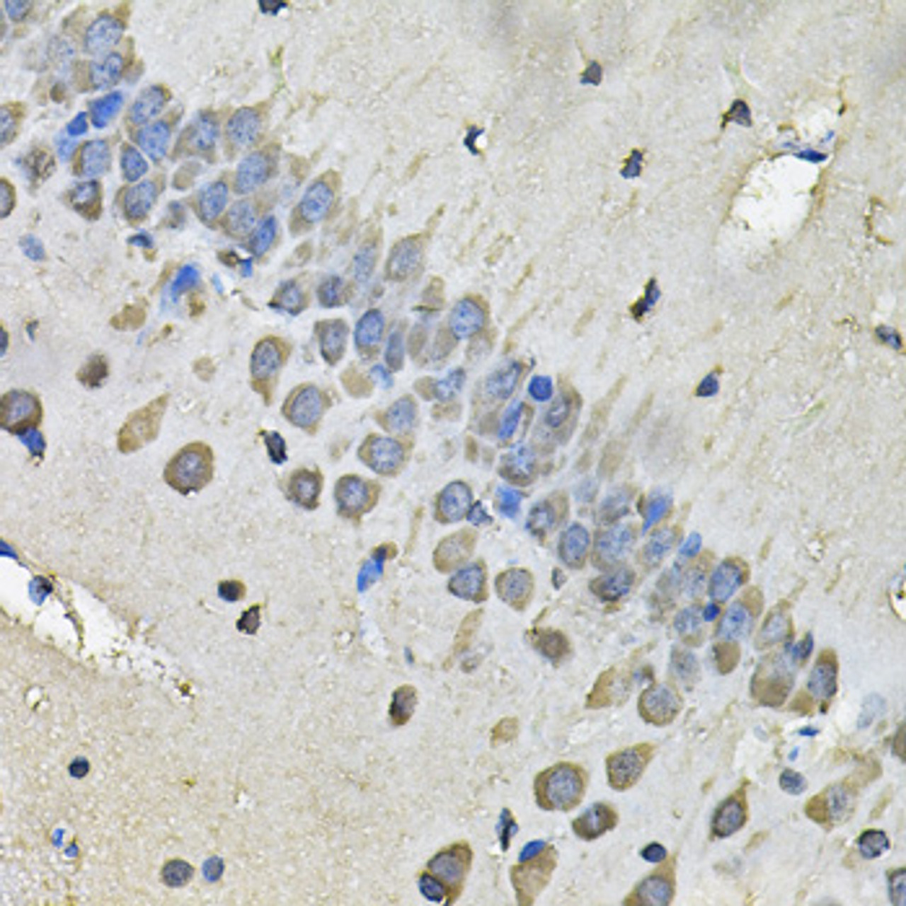 Immunohistochemistry of paraffin-embedded rat brain using MYH1 Antibody (22-566) at dilution of 1:100 (40x lens) .