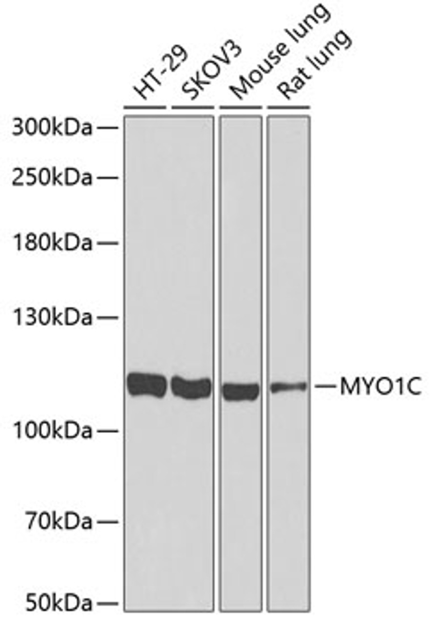 Western blot analysis of extracts of various cell lines, using MYO1C antibody (22-567) at 1:1000 dilution.<br/>Secondary antibody: HRP Goat Anti-Rabbit IgG (H+L) at 1:10000 dilution.<br/>Lysates/proteins: 25ug per lane.<br/>Blocking buffer: 3% nonfat dry milk in TBST.<br/>Detection: ECL Basic Kit.<br/>Exposure time: 90s.