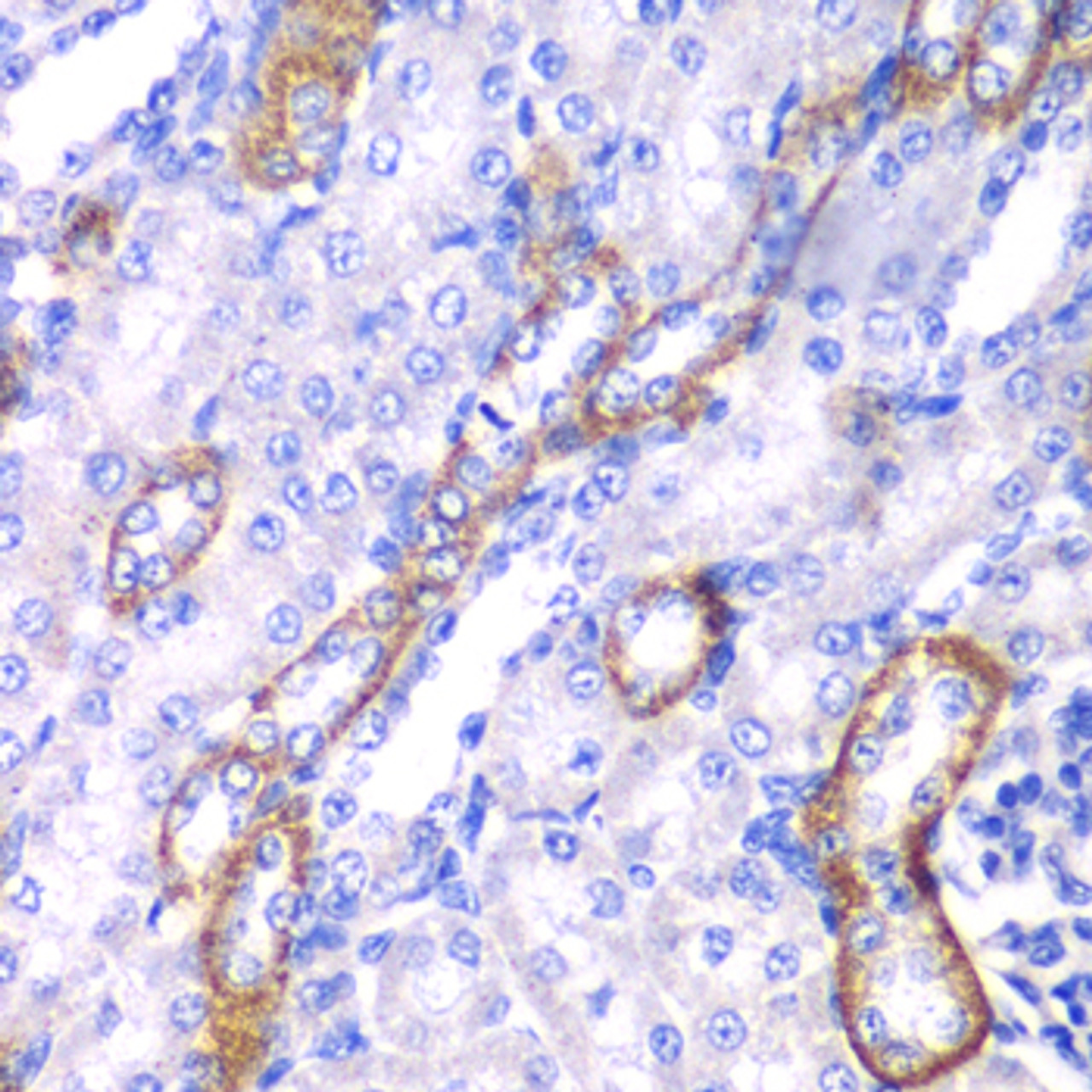 Immunohistochemistry of paraffin-embedded rat kidney using MYO1C antibody (22-567) at dilution of 1:100 (40x lens) .