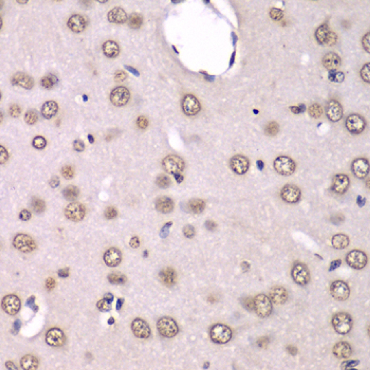 Immunohistochemistry of paraffin-embedded rat brain using HNRNPM antibody (22-568) at dilution of 1:100 (40x lens) .