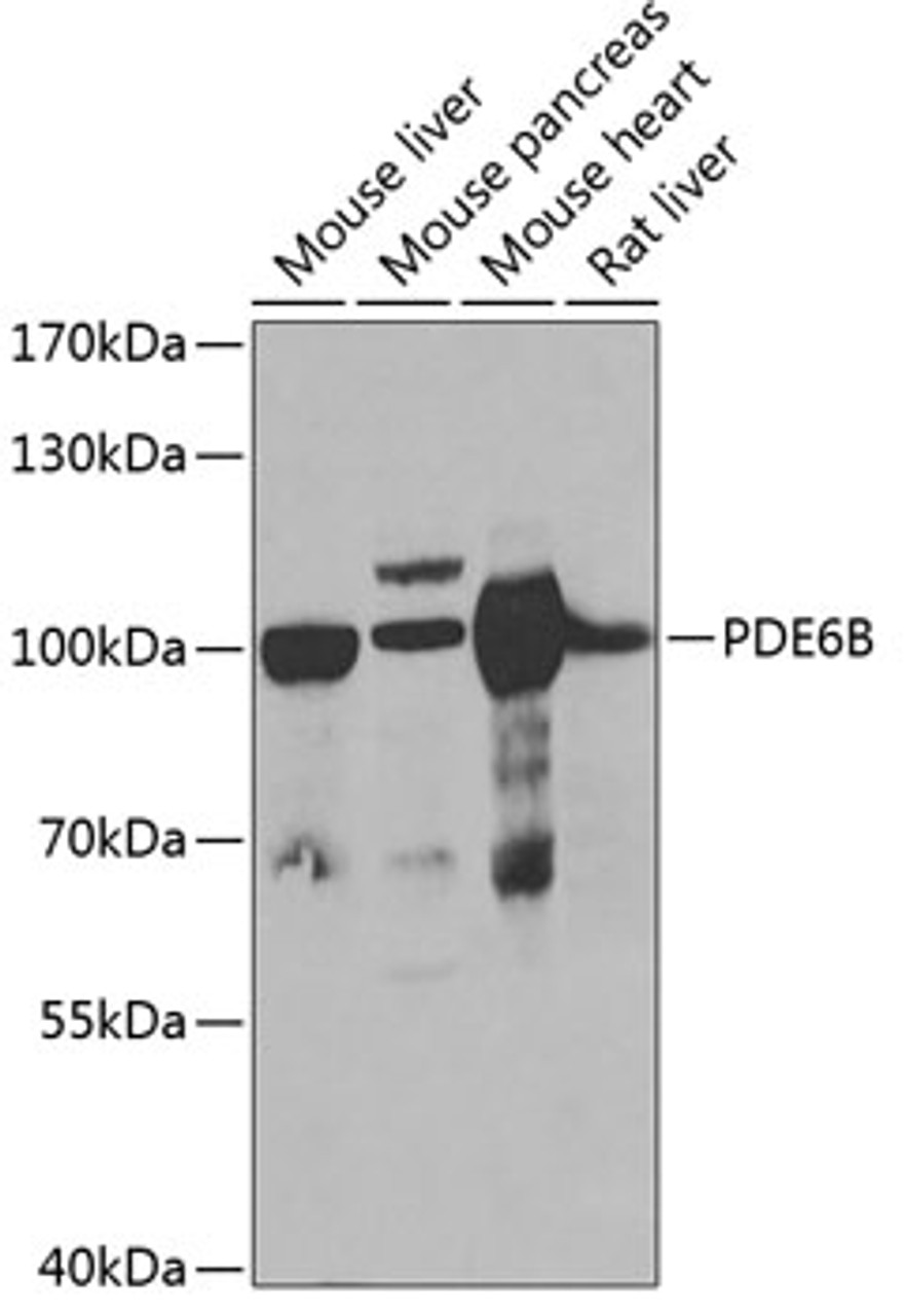 Western blot analysis of extracts of various cell lines, using PDE6B antibody (22-572) at 1:1000 dilution.<br/>Secondary antibody: HRP Goat Anti-Rabbit IgG (H+L) at 1:10000 dilution.<br/>Lysates/proteins: 25ug per lane.<br/>Blocking buffer: 3% nonfat dry milk in TBST.<br/>Detection: ECL Basic Kit.<br/>Exposure time: 90s.