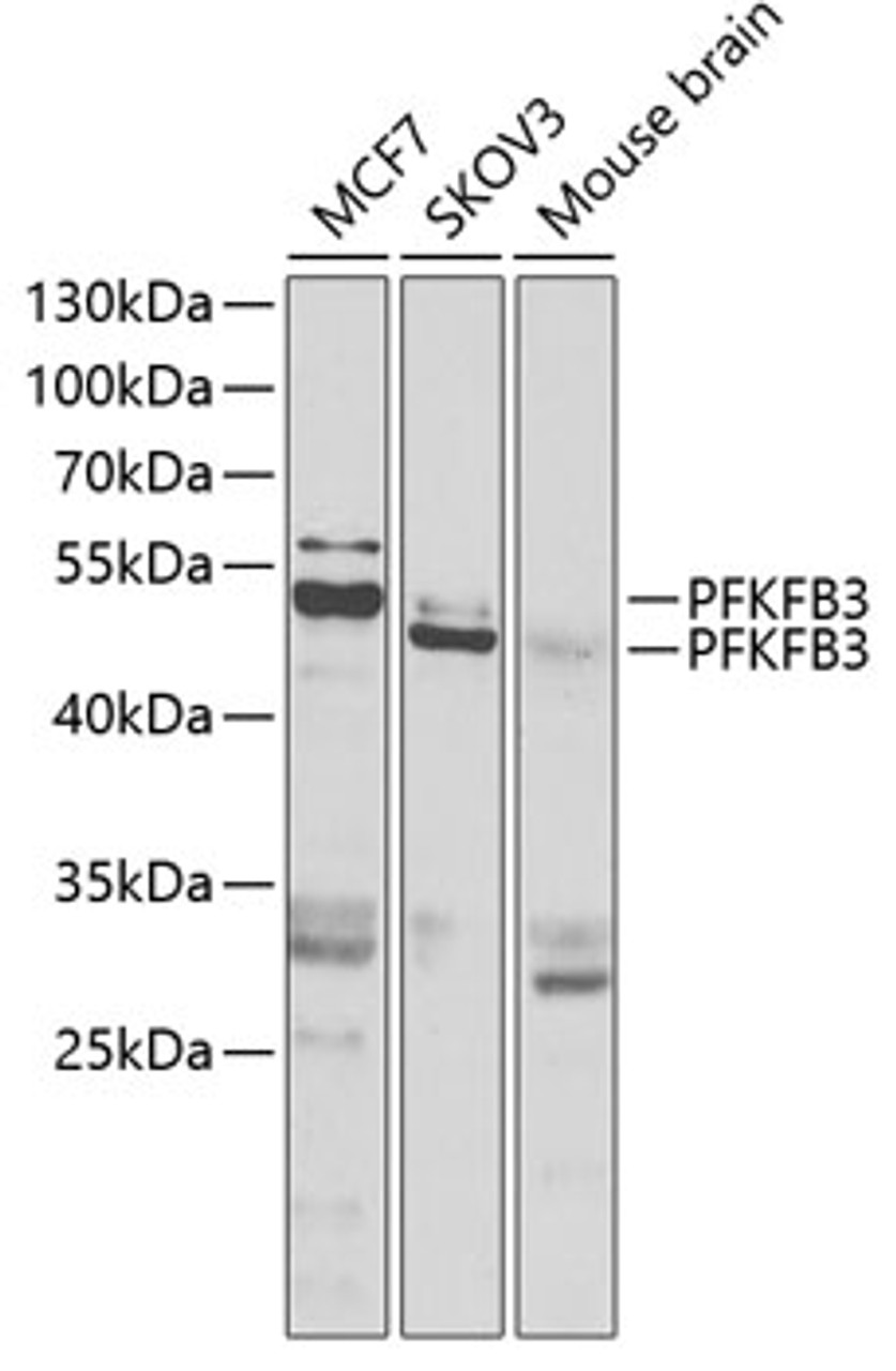 Western blot analysis of extracts of various cell lines, using PFKFB3 antibody (22-575) at 1:1000 dilution.<br/>Secondary antibody: HRP Goat Anti-Rabbit IgG (H+L) at 1:10000 dilution.<br/>Lysates/proteins: 25ug per lane.<br/>Blocking buffer: 3% nonfat dry milk in TBST.<br/>Detection: ECL Basic Kit.<br/>Exposure time: 90s.