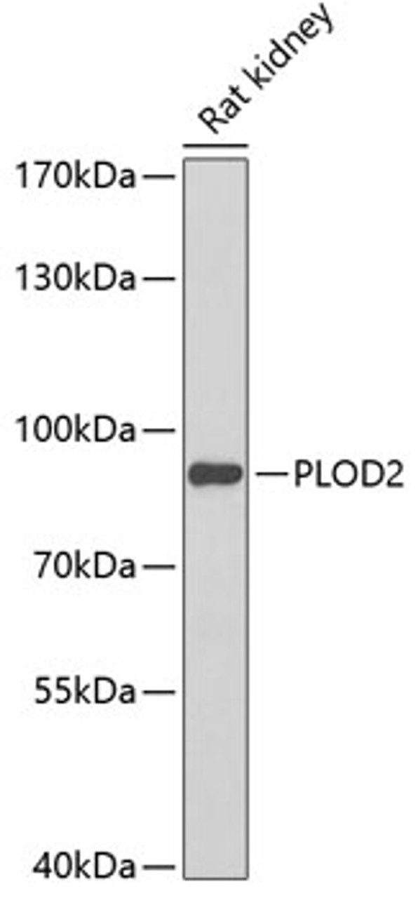 Western blot analysis of extracts of rat kidney, using PLOD2 Antibody (22-576) at 1:1000 dilution.<br/>Secondary antibody: HRP Goat Anti-Rabbit IgG (H+L) at 1:10000 dilution.<br/>Lysates/proteins: 25ug per lane.<br/>Blocking buffer: 3% nonfat dry milk in TBST.<br/>Detection: ECL Basic Kit.<br/>Exposure time: 90s.