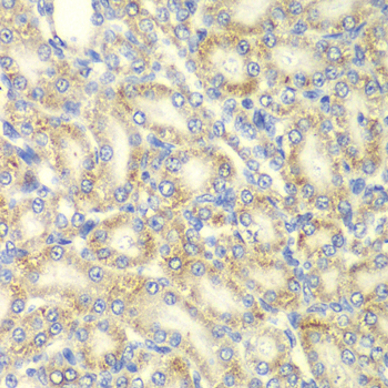 Immunohistochemistry of paraffin-embedded rat kidney using PRKAB2 antibody (22-582) at dilution of 1:100 (40x lens) .