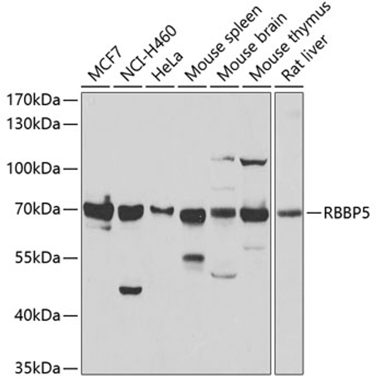 Western blot analysis of extracts of various cell lines, using RBBP5 antibody (22-592) at 1:1000 dilution.<br/>Secondary antibody: HRP Goat Anti-Rabbit IgG (H+L) at 1:10000 dilution.<br/>Lysates/proteins: 25ug per lane.<br/>Blocking buffer: 3% nonfat dry milk in TBST.<br/>Detection: ECL Basic Kit.<br/>Exposure time: 10s.