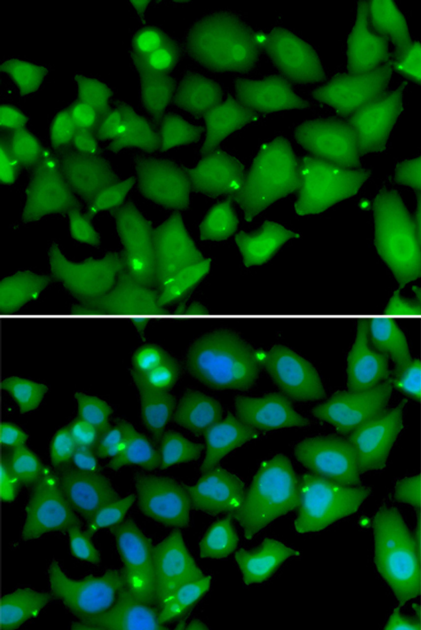 Immunofluorescence analysis of MCF-7 cells using RBBP7 antibody (22-594) . Blue: DAPI for nuclear staining.