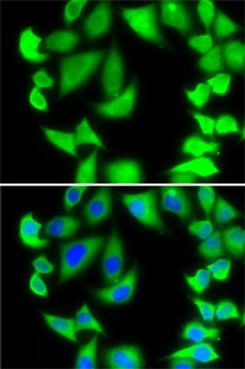 Immunofluorescence analysis of MCF7 cells using RPS5 antibody (22-598) . Blue: DAPI for nuclear staining.