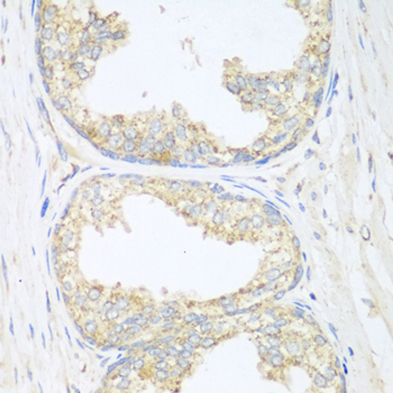 Immunohistochemistry of paraffin-embedded human prostate using SGCB antibody (22-602) at dilution of 1:100 (40x lens) .