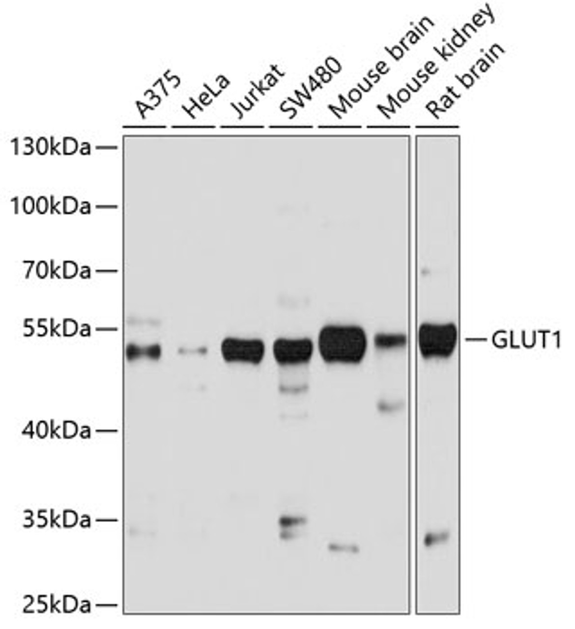 Western blot analysis of extracts of various cell lines, using GLUT1 antibody (22-604) at 1:1000 dilution.<br/>Secondary antibody: HRP Goat Anti-Rabbit IgG (H+L) at 1:10000 dilution.<br/>Lysates/proteins: 25ug per lane.<br/>Blocking buffer: 3% nonfat dry milk in TBST.<br/>Detection: ECL Basic Kit.<br/>Exposure time: 5s.