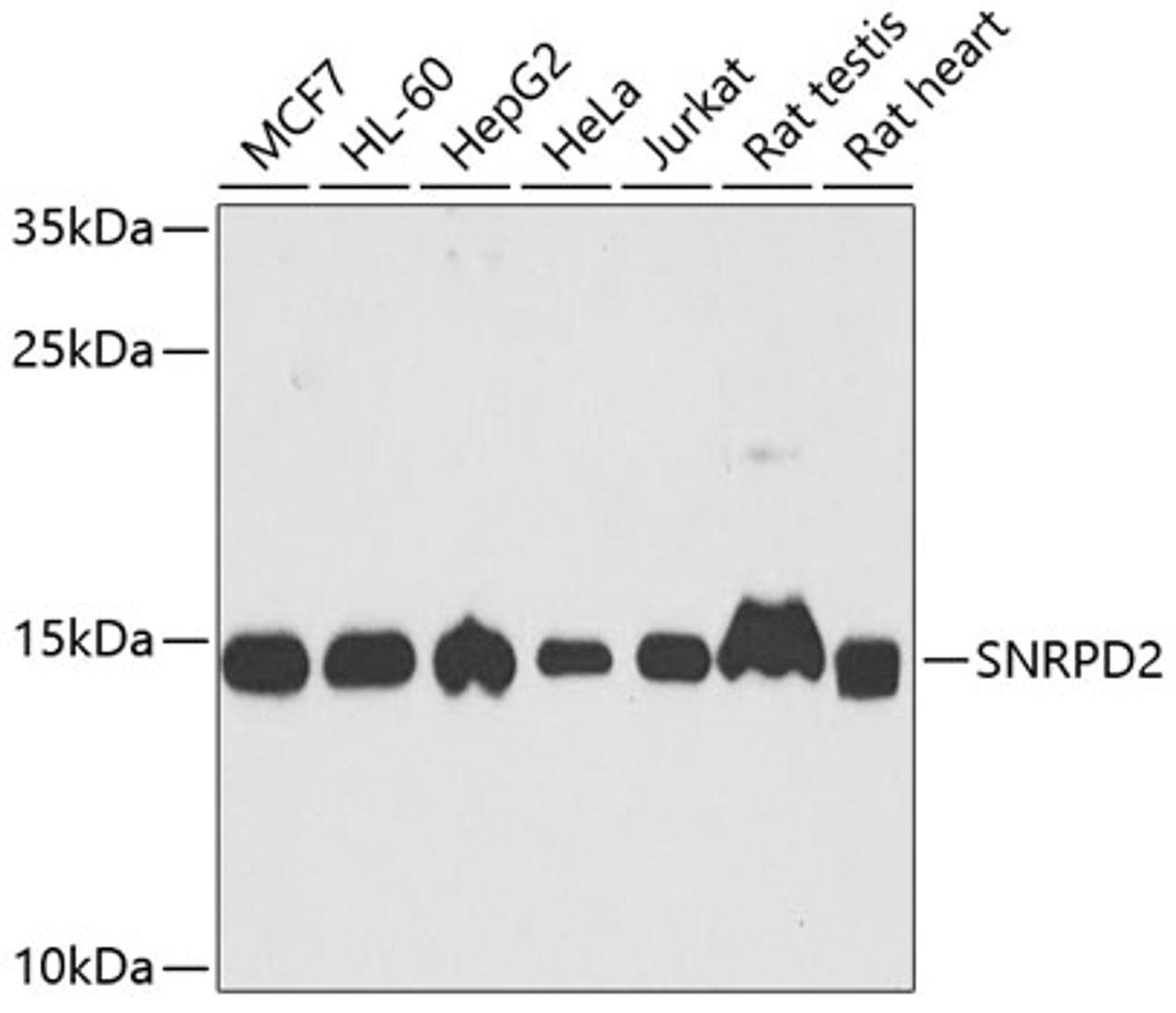 Western blot analysis of extracts of various cell lines, using SNRPD2 antibody (22-605) at 1:1000 dilution.<br/>Secondary antibody: HRP Goat Anti-Rabbit IgG (H+L) at 1:10000 dilution.<br/>Lysates/proteins: 25ug per lane.<br/>Blocking buffer: 3% nonfat dry milk in TBST.<br/>Detection: ECL Basic Kit.<br/>Exposure time: 30s.