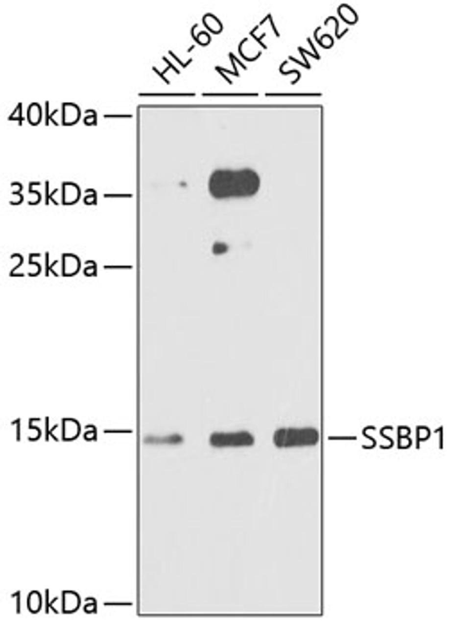 Western blot analysis of extracts of various cell lines, using SSBP1 antibody (22-609) at 1:1000 dilution.<br/>Secondary antibody: HRP Goat Anti-Rabbit IgG (H+L) at 1:10000 dilution.<br/>Lysates/proteins: 25ug per lane.<br/>Blocking buffer: 3% nonfat dry milk in TBST.<br/>Detection: ECL Basic Kit.<br/>Exposure time: 30s.