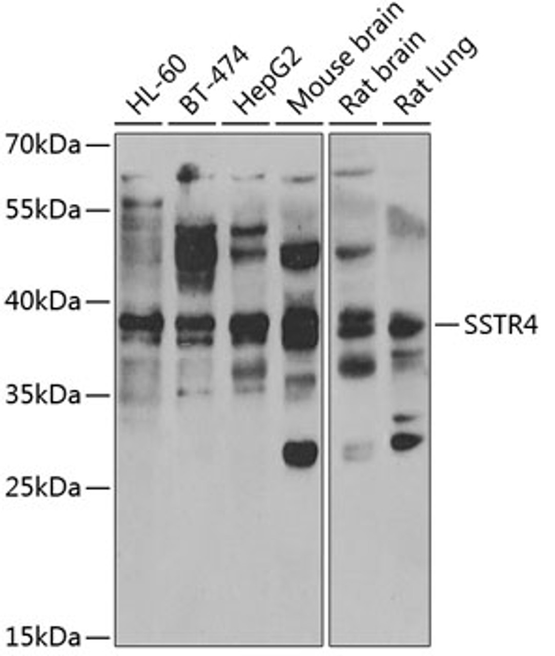 Western blot analysis of extracts of various cell lines, using SSTR4 antibody (22-610) at 1:1000 dilution._Secondary antibody: HRP Goat Anti-Rabbit IgG (H+L) at 1:10000 dilution._Lysates/proteins: 25ug per lane._Blocking buffer: 3% nonfat dry milk in TBST._Detection: ECL Enhanced Kit._Exposure time: 300s.