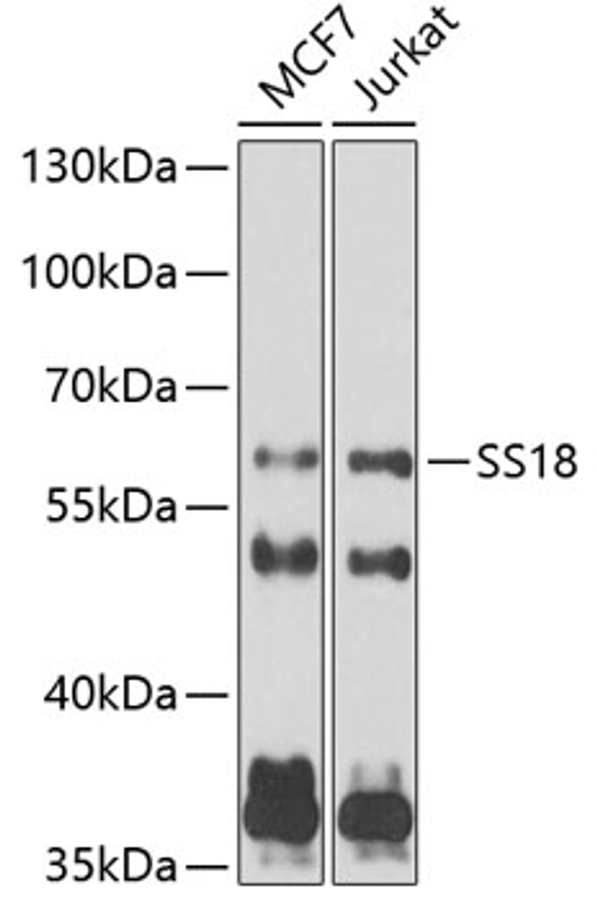 Western blot analysis of extracts of various cell lines, using SS18 antibody (22-612) at 1:1000 dilution.<br/>Secondary antibody: HRP Goat Anti-Rabbit IgG (H+L) at 1:10000 dilution.<br/>Lysates/proteins: 25ug per lane.<br/>Blocking buffer: 3% nonfat dry milk in TBST.<br/>Detection: ECL Basic Kit.<br/>Exposure time: 30s.