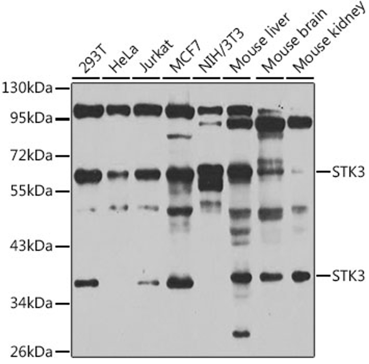 Western blot analysis of extracts of various cell lines, using STK3 antibody (22-614) at 1:1000 dilution.<br/>Secondary antibody: HRP Goat Anti-Rabbit IgG (H+L) at 1:10000 dilution.<br/>Lysates/proteins: 25ug per lane.<br/>Blocking buffer: 3% nonfat dry milk in TBST.<br/>Detection: ECL Basic Kit.<br/>Exposure time: 60s.