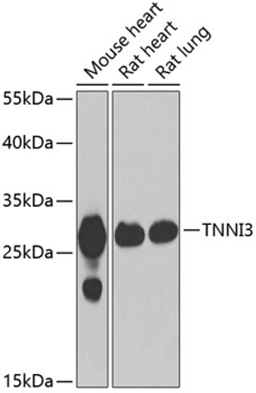 Western blot analysis of extracts of various cell lines, using TNNI3 antibody (22-617) at 1:1000 dilution.<br/>Secondary antibody: HRP Goat Anti-Rabbit IgG (H+L) at 1:10000 dilution.<br/>Lysates/proteins: 25ug per lane.<br/>Blocking buffer: 3% nonfat dry milk in TBST.<br/>Detection: ECL Basic Kit.<br/>Exposure time: 5s.
