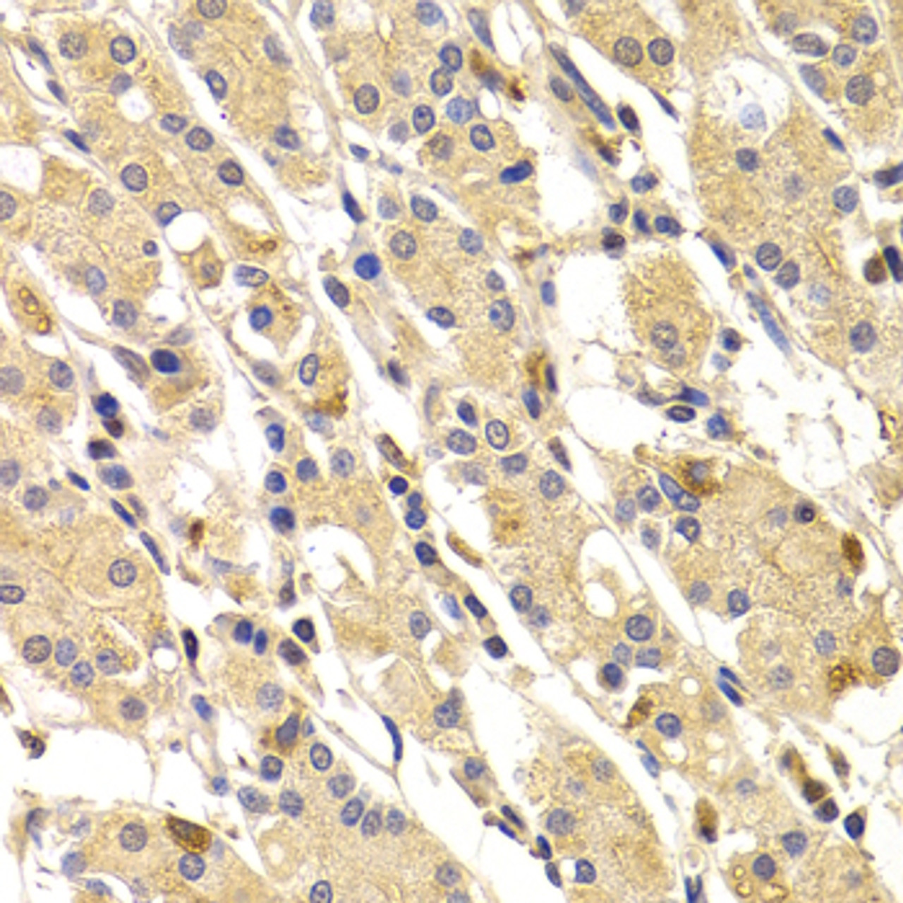 Immunohistochemistry of paraffin-embedded human stomach using TNNI3 antibody (22-617) at dilution of 1:100 (40x lens) .