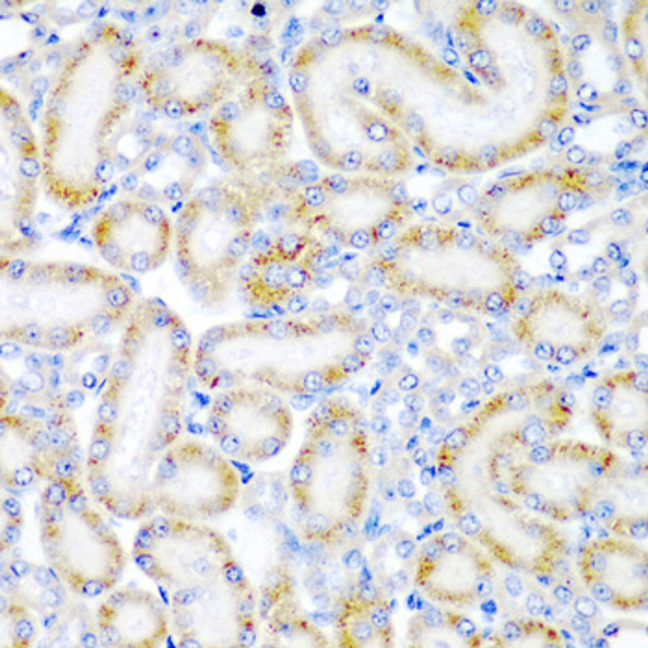 Immunohistochemistry of paraffin-embedded rat kidney using WRB antibody (22-621) at dilution of 1:200 (40x lens) .