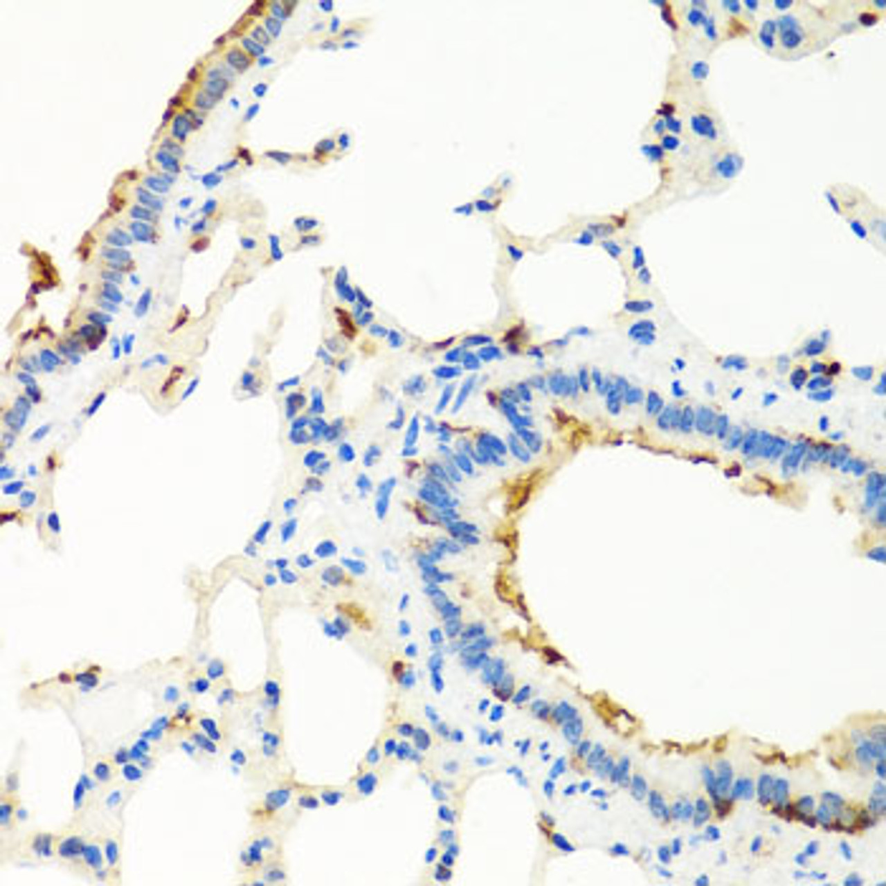 Immunohistochemistry of paraffin-embedded rat lung using RGS5 antibody (22-632) at dilution of 1:100 (40x lens) .