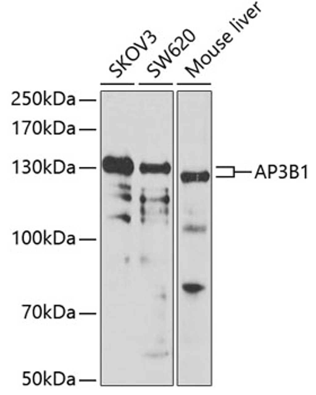 Western blot analysis of extracts of various cell lines, using AP3B1 antibody (22-636) at 1:1000 dilution.<br/>Secondary antibody: HRP Goat Anti-Rabbit IgG (H+L) at 1:10000 dilution.<br/>Lysates/proteins: 25ug per lane.<br/>Blocking buffer: 3% nonfat dry milk in TBST.<br/>Detection: ECL Basic Kit.<br/>Exposure time: 90s.