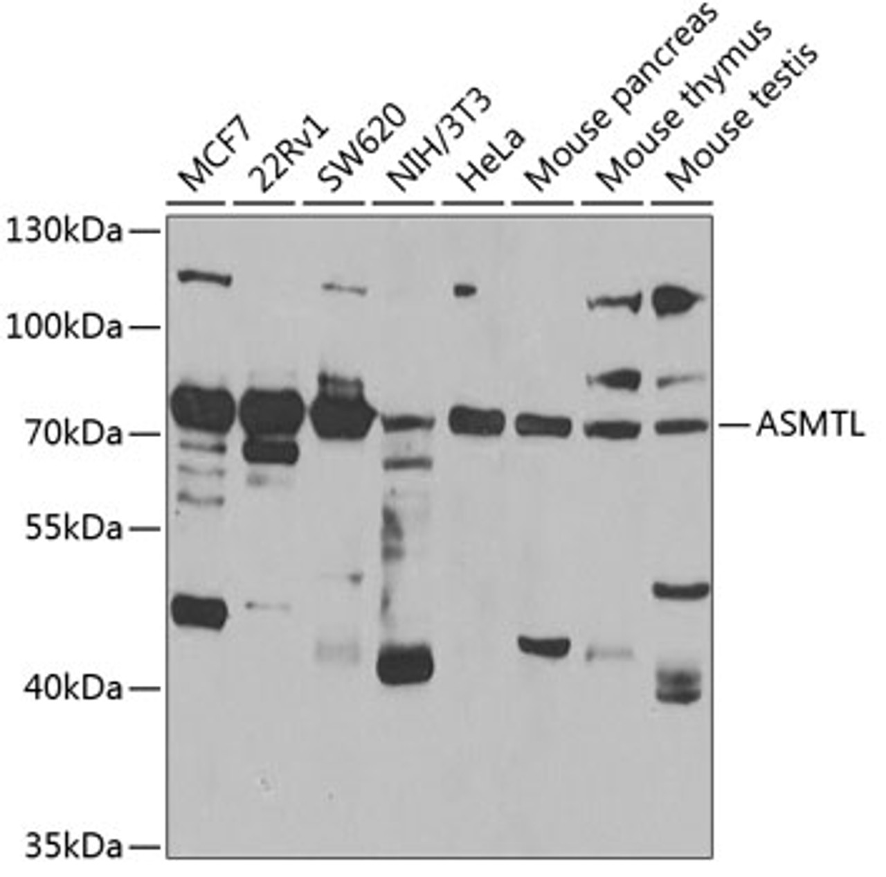 Western blot analysis of extracts of various cell lines, using ASMTL antibody (22-637) at 1:1000 dilution.<br/>Secondary antibody: HRP Goat Anti-Rabbit IgG (H+L) at 1:10000 dilution.<br/>Lysates/proteins: 25ug per lane.<br/>Blocking buffer: 3% nonfat dry milk in TBST.