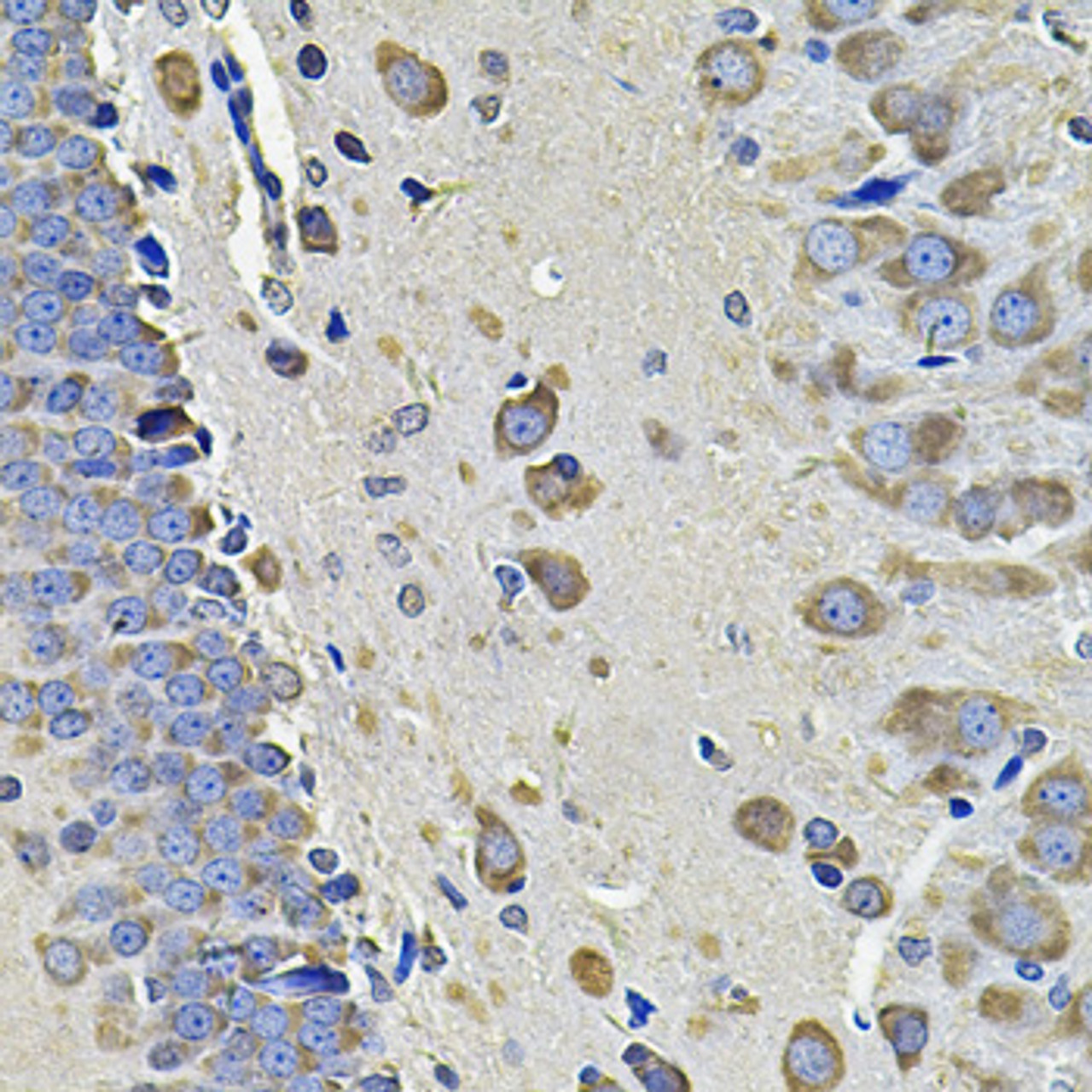 Immunohistochemistry of paraffin-embedded rat brain using EIF3C Antibody (22-638) at dilution of 1:100 (40x lens) .