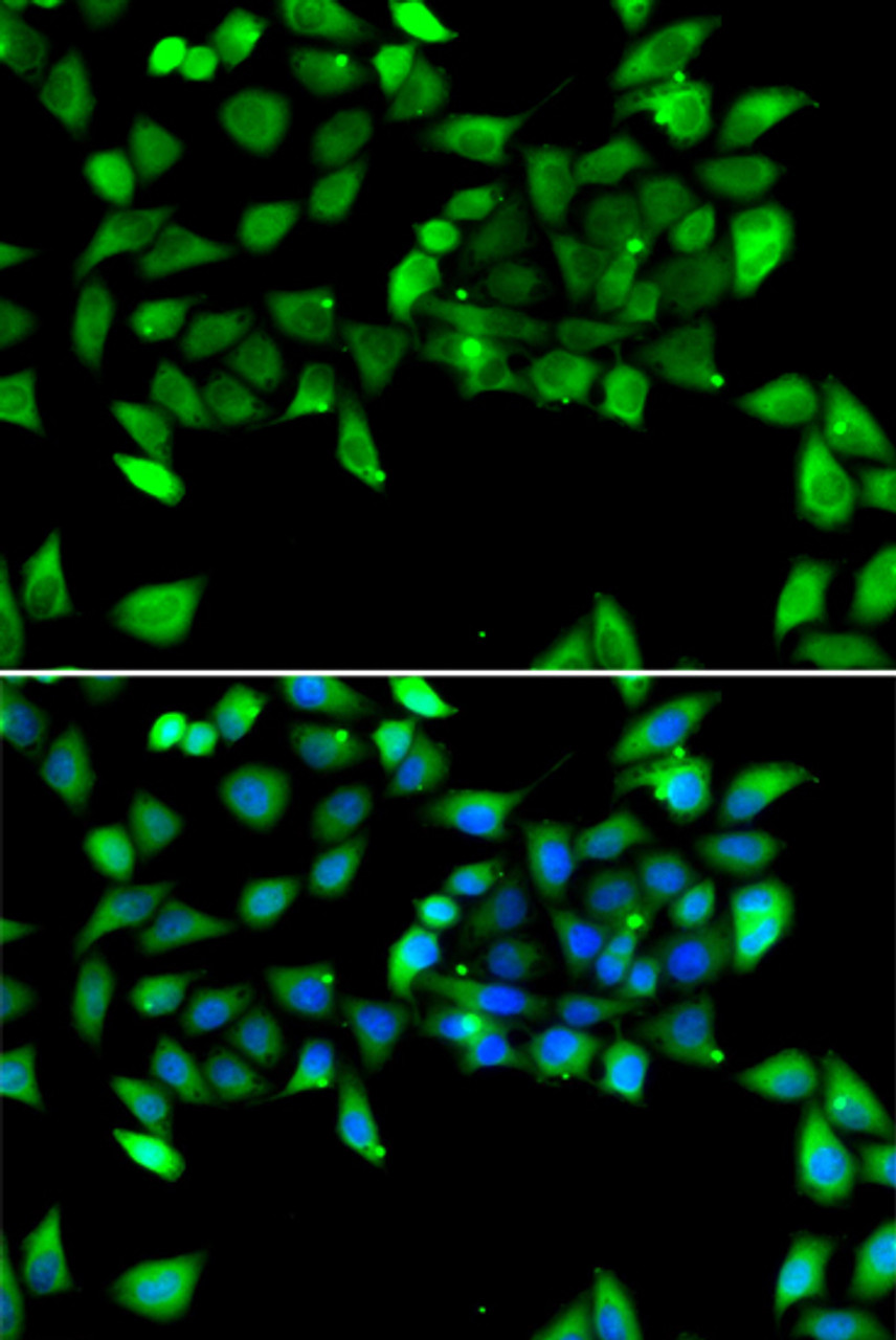 Immunofluorescence analysis of U2OS cells using EIF3H antibody (22-640) . Blue: DAPI for nuclear staining.