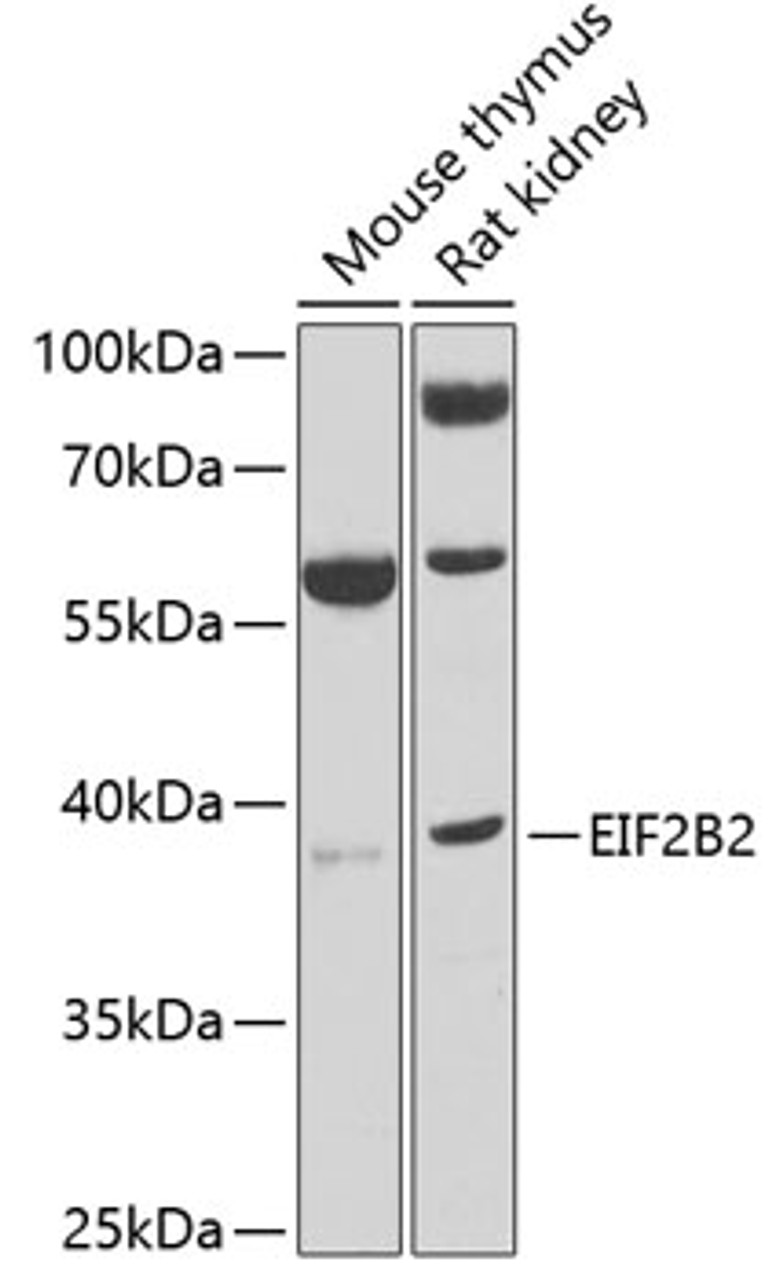 Western blot analysis of extracts of various cell lines, using EIF2B2 antibody (22-641) at 1:1000 dilution.<br/>Secondary antibody: HRP Goat Anti-Rabbit IgG (H+L) at 1:10000 dilution.<br/>Lysates/proteins: 25ug per lane.<br/>Blocking buffer: 3% nonfat dry milk in TBST.<br/>Detection: ECL Basic Kit.<br/>Exposure time: 10s.