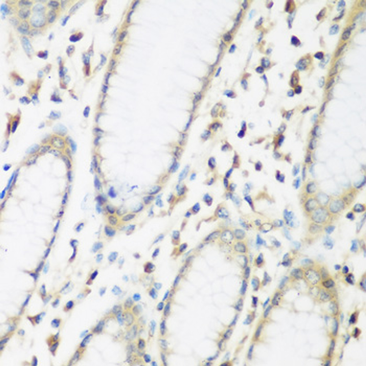 Immunohistochemistry of paraffin-embedded human stomach using EIF2B2 antibody (22-641) at dilution of 1:200 (40x lens) .