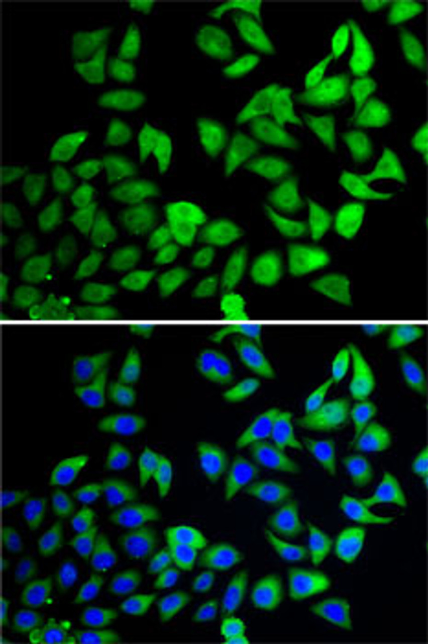 Immunofluorescence analysis of A-549 cells using USP8 antibody (22-643) . Blue: DAPI for nuclear staining.