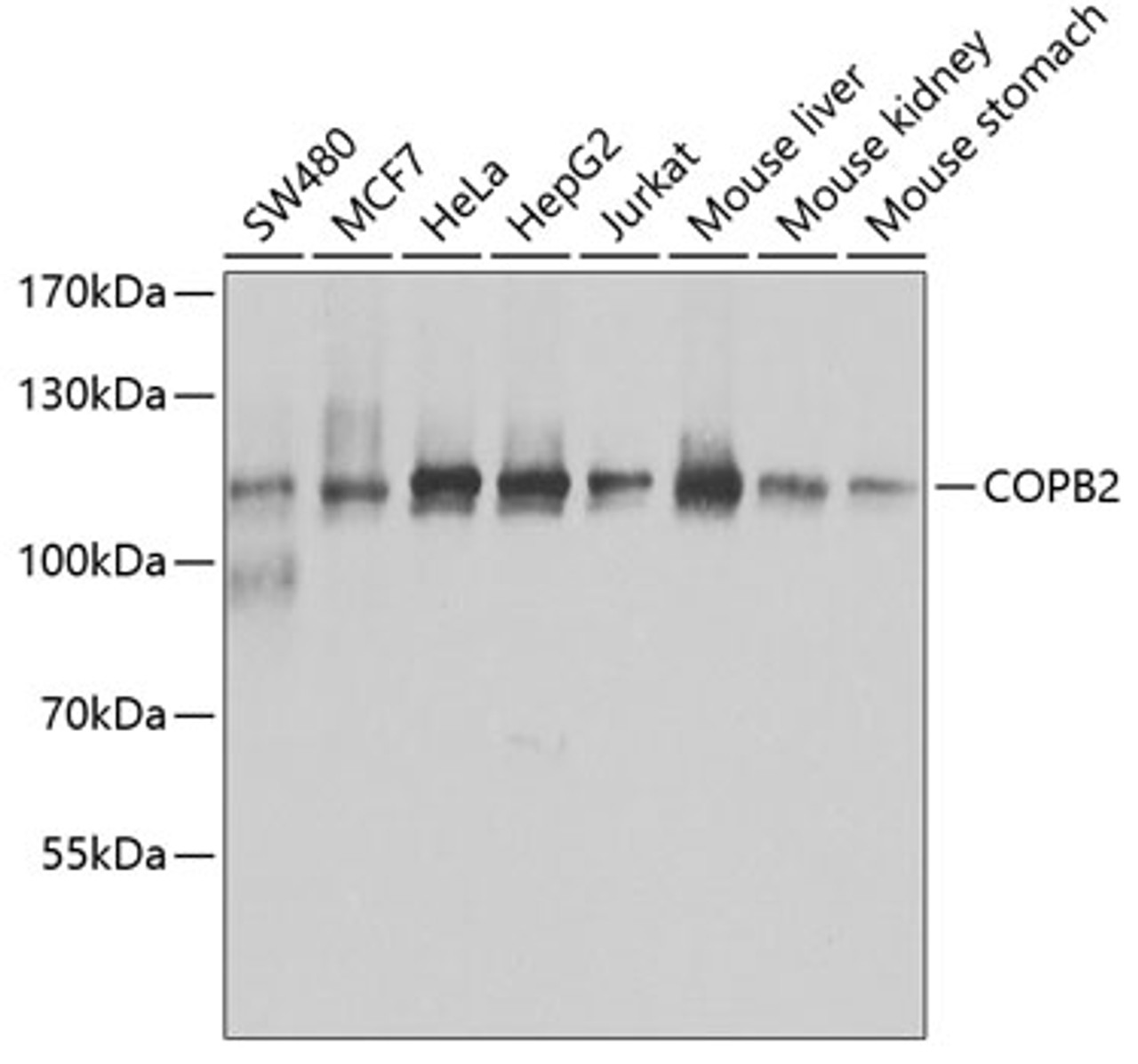 Western blot analysis of extracts of various cell lines, using COPB2 antibody (22-648) at 1:1000 dilution.<br/>Secondary antibody: HRP Goat Anti-Rabbit IgG (H+L) at 1:10000 dilution.<br/>Lysates/proteins: 25ug per lane.<br/>Blocking buffer: 3% nonfat dry milk in TBST.<br/>Detection: ECL Basic Kit.<br/>Exposure time: 5s.