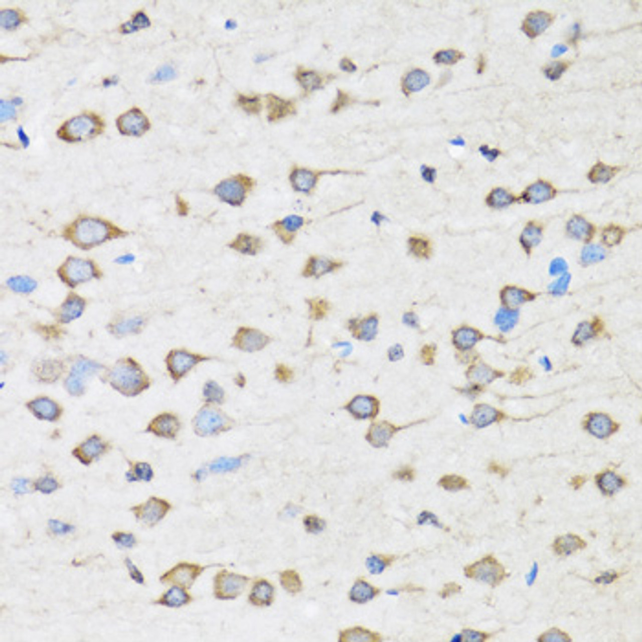 Immunohistochemistry of paraffin-embedded rat brain using COPB2 antibody (22-648) at dilution of 1:100 (40x lens) .