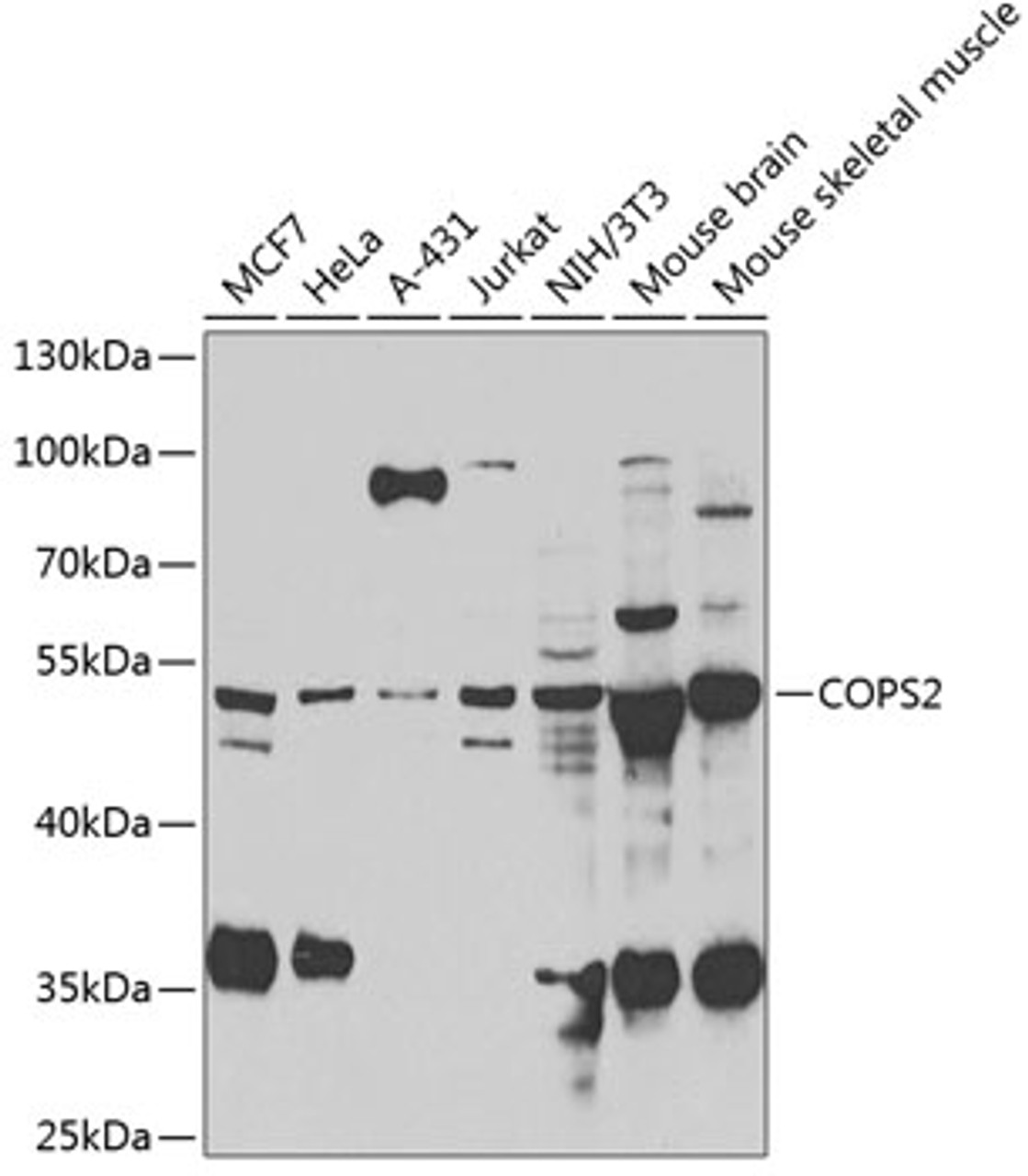Western blot analysis of extracts of various cell lines, using COPS2 antibody (22-649) at 1:1000 dilution.<br/>Secondary antibody: HRP Goat Anti-Rabbit IgG (H+L) at 1:10000 dilution.<br/>Lysates/proteins: 25ug per lane.<br/>Blocking buffer: 3% nonfat dry milk in TBST.<br/>Detection: ECL Basic Kit.<br/>Exposure time: 90s.