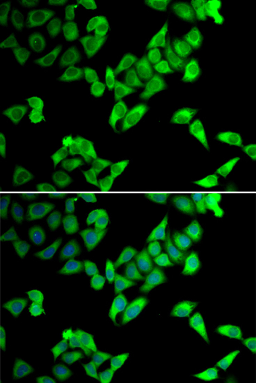 Immunofluorescence analysis of U2OS cells using TRIP10 antibody (22-650) . Blue: DAPI for nuclear staining.