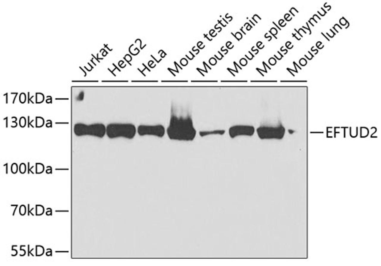 Western blot analysis of extracts of various cell lines, using EFTUD2 antibody (22-651) at 1:2000 dilution.<br/>Secondary antibody: HRP Goat Anti-Rabbit IgG (H+L) at 1:10000 dilution.<br/>Lysates/proteins: 25ug per lane.<br/>Blocking buffer: 3% nonfat dry milk in TBST.<br/>Detection: ECL Enhanced Kit.<br/>Exposure time: 20s.