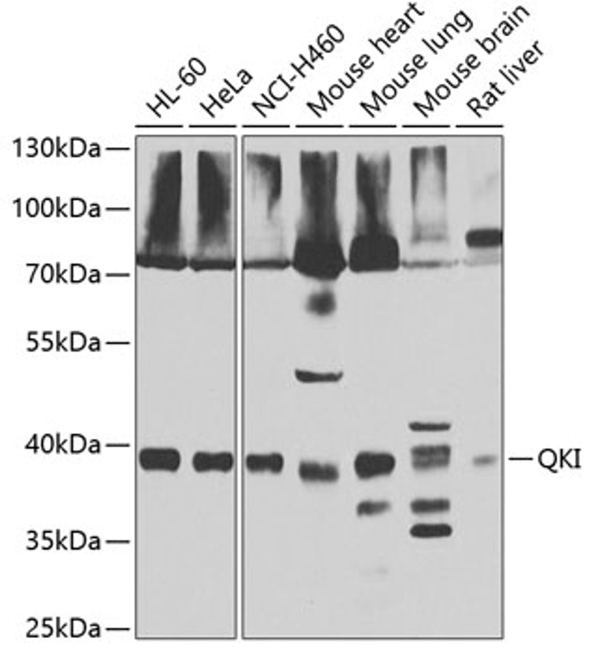 Western blot analysis of extracts of various cell lines, using QKI antibody (22-654) at 1:1000 dilution._Secondary antibody: HRP Goat Anti-Rabbit IgG (H+L) at 1:10000 dilution._Lysates/proteins: 25ug per lane._Blocking buffer: 3% nonfat dry milk in TBST._Detection: ECL Enhanced Kit._Exposure time: 30s.