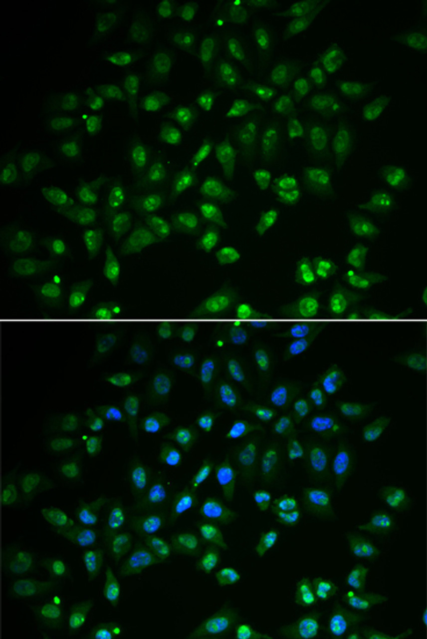 Immunofluorescence analysis of A549 cells using HAND2 antibody (22-655) . Blue: DAPI for nuclear staining.