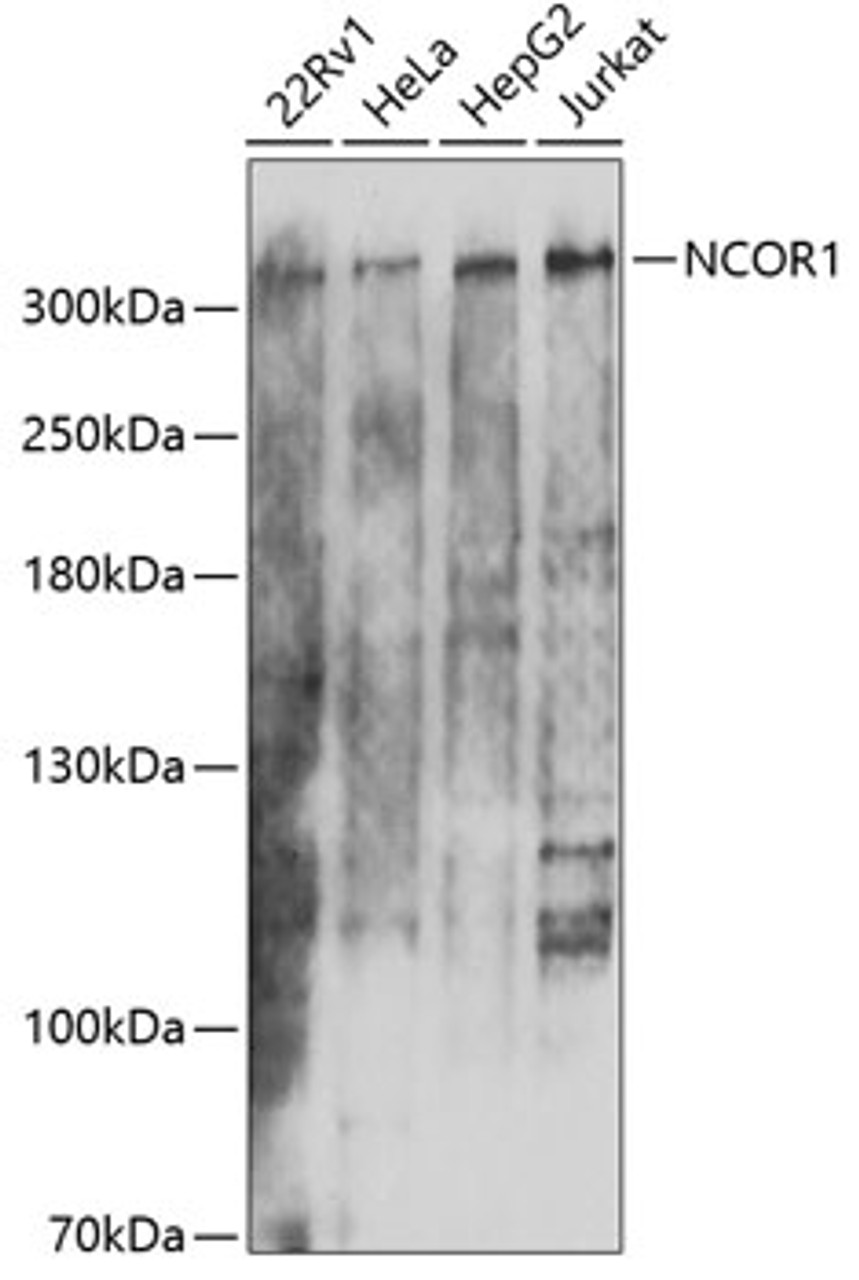 Western blot analysis of extracts of various cell lines, using NCOR1 antibody (22-657) at 1:1000 dilution.<br/>Secondary antibody: HRP Goat Anti-Rabbit IgG (H+L) at 1:10000 dilution.<br/>Lysates/proteins: 25ug per lane.<br/>Blocking buffer: 3% nonfat dry milk in TBST.<br/>Detection: ECL Basic Kit.<br/>Exposure time: 90s.