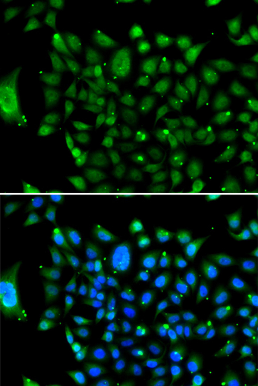 Immunofluorescence analysis of U2OS cells using NCOR1 antibody (22-657) . Blue: DAPI for nuclear staining.